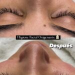 FF61AECE 2B32 4483 9F32 00FC69CD39D8 Limpieza Facial Exprés