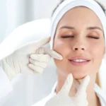 mesoterapia facial beneficios madrid Peeling Antimanchas