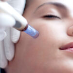 micropunciones Limpieza Facial Profunda + Dermapen